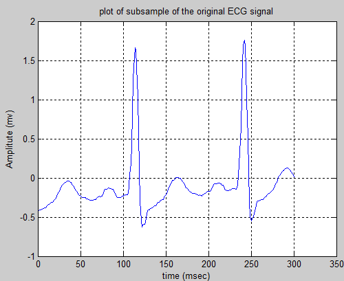 Hello and Welcome to my Biomedical Signal and Image processing blog