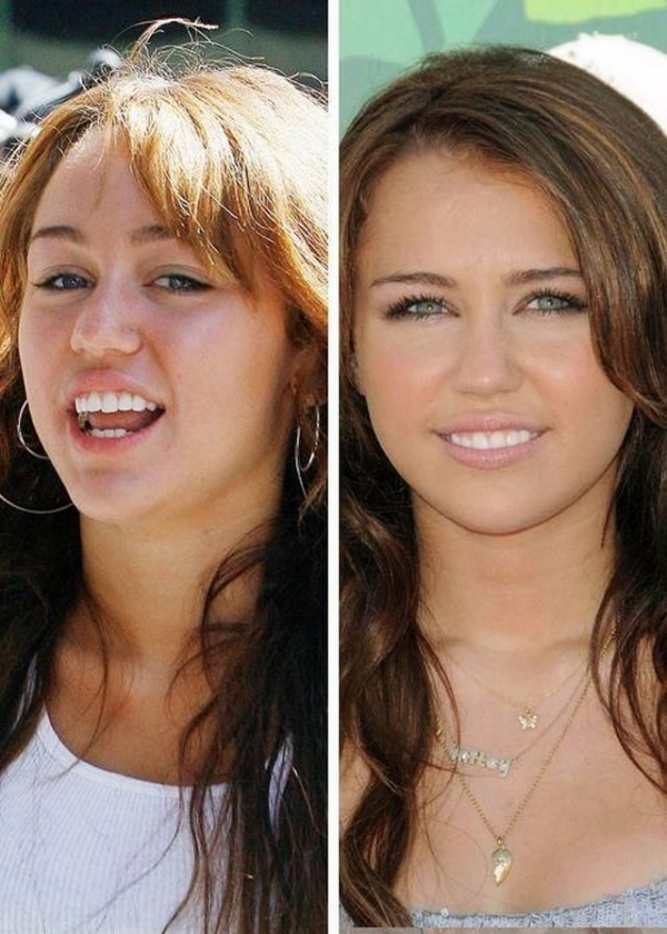 Hollywood Famous Stars Celebrities With Out Makeup.