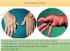 What are the Diagnostic criteria for rheumatoid arthritis?