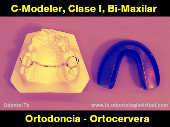 ORTODONCIA: C-Modeler, Clase I, Bi-Maxilar
