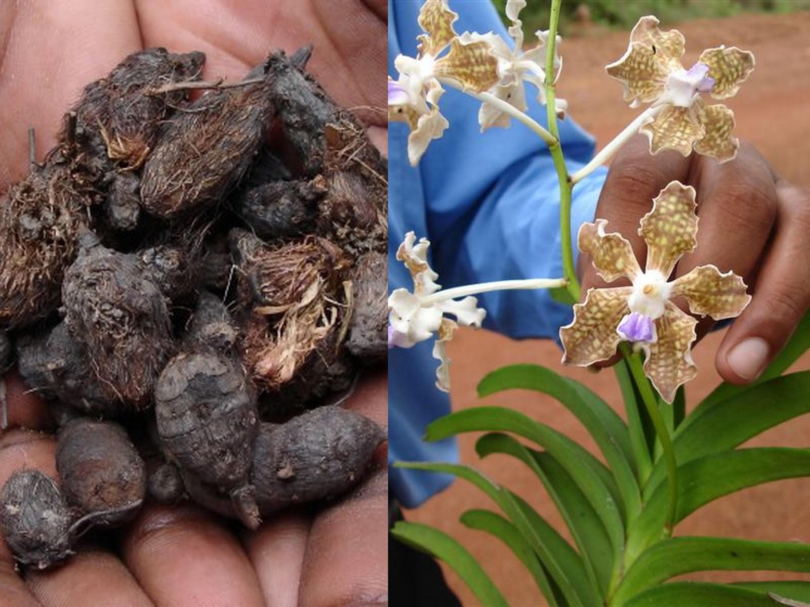 agenesia sacro coccinea sintomi