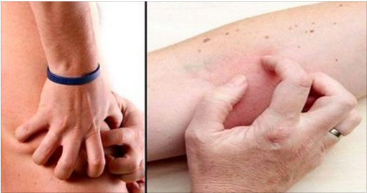 Attention ! 4 symptômes de maladies rénales que vous ne devez jamais ignorer !