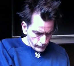 charlie sheen hair transplant