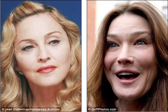 Famous and Celebrities: Curse of the cat face: Big cheeks and high