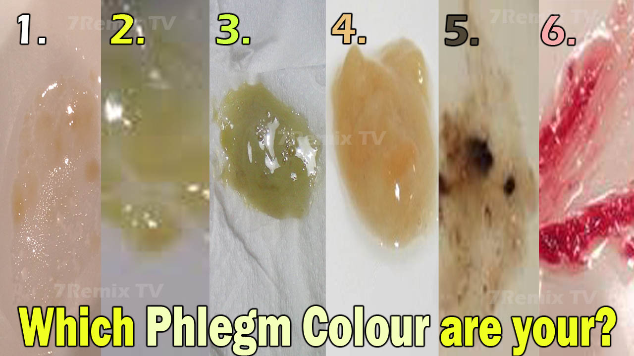 What Does the Color of My Phlegm Means? Yellow, Brown, Green, and More