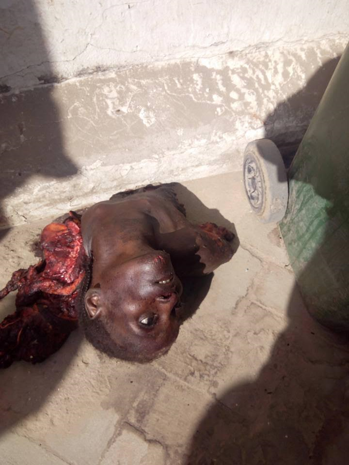 Graphic photos of the female suicide bomber that attacked a market in