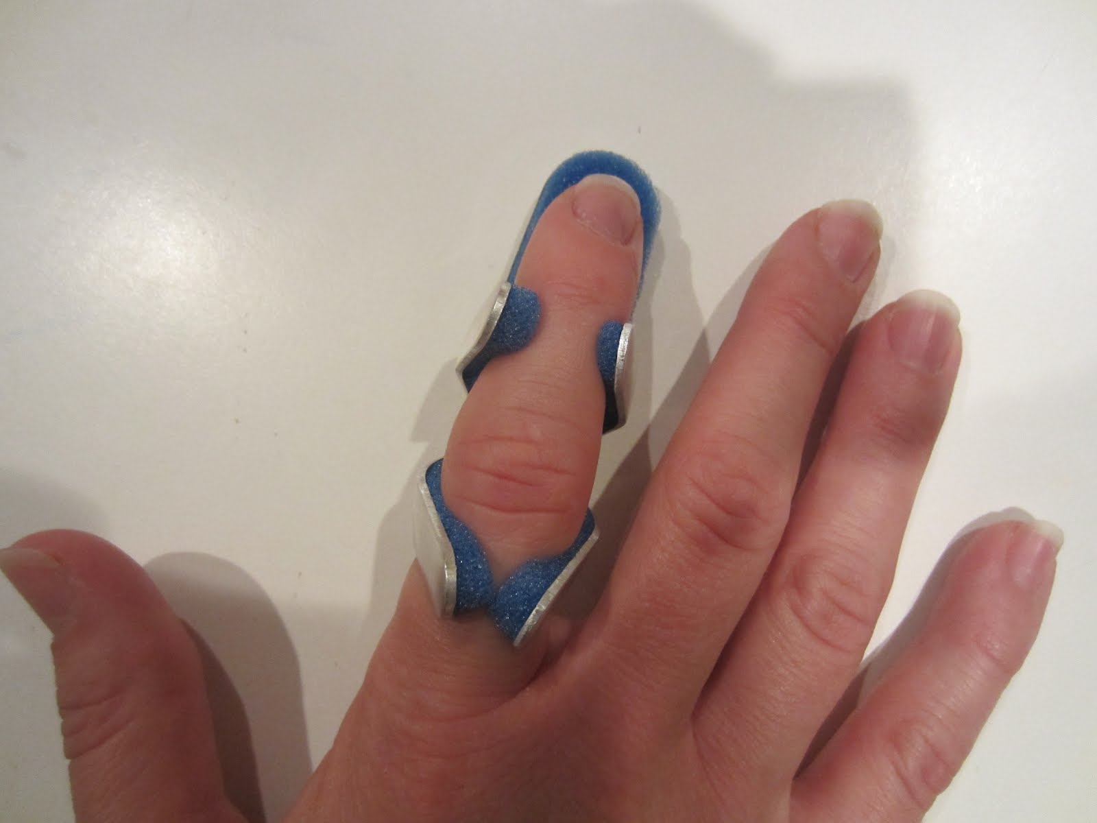 the-essence-broken-finger