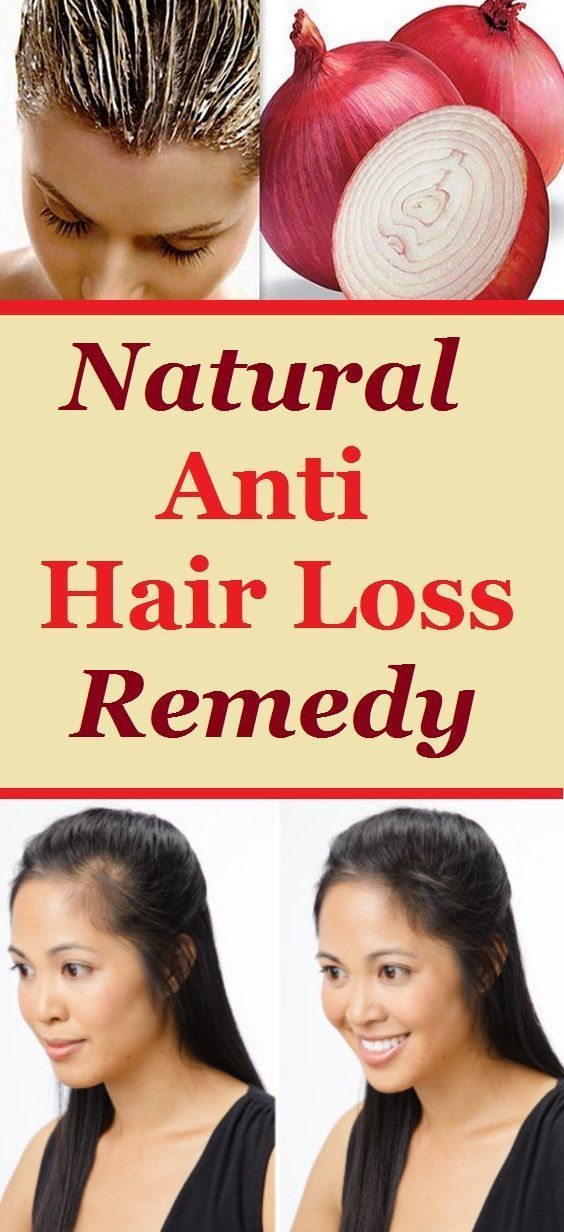 Home Remedies for Hair Loss whathurtsthemost