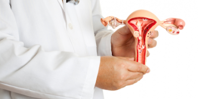 Hình ảnh bệnh lạc nội mạc tử cung