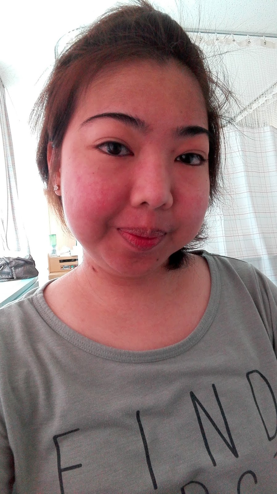 Fighting Lupus in Japan New roller coaster ride! July 15, 2018 (Sunday)