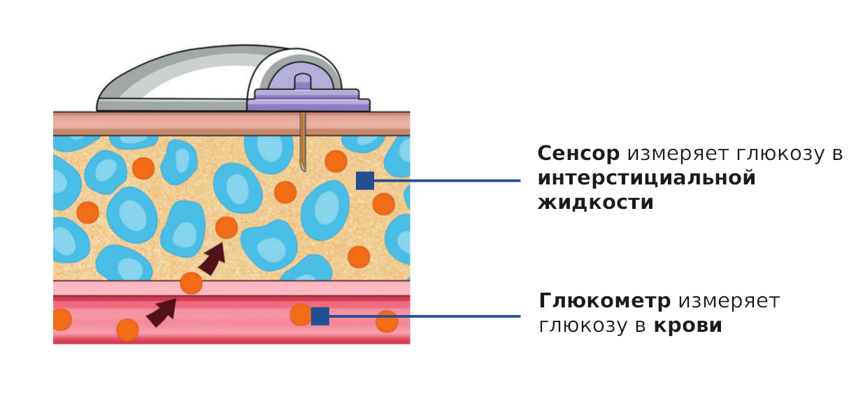 СУТОЧНОЕ МОНИТОРИРОВАНИЕ ГЛЮКОЗЫ В КРОВИ с помощью прибора i Pro 2 - ООО "Семейн