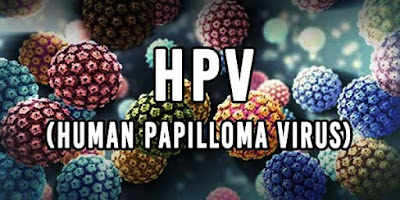 Kutil kelamin HPV