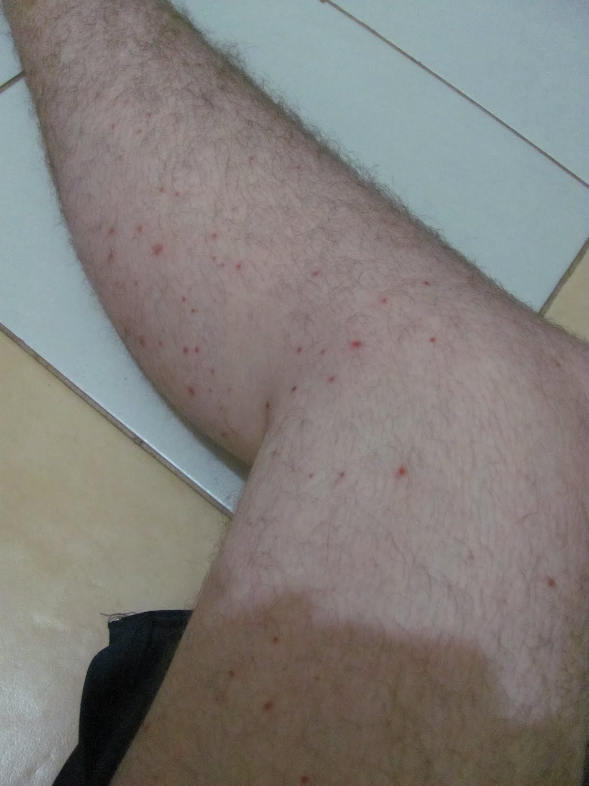 Fleas Infestation? Peroxide'S Unexpected Solution - 7kaq18v