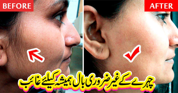 Remove Unwanted Hair from Face at Home Tips in Urdu / Hindi