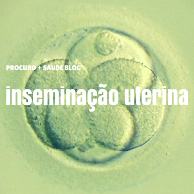 IIU - inseminação uterina (intra-uterina)