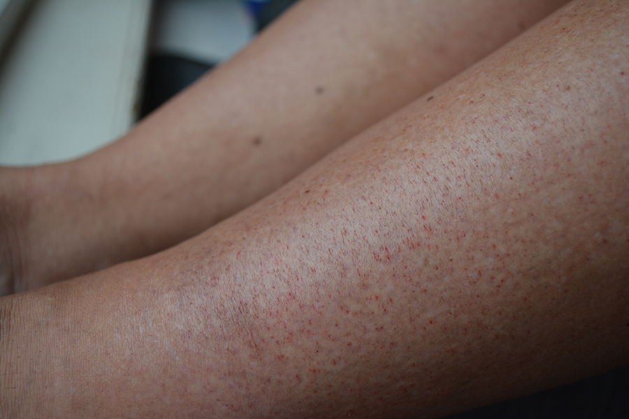 Met Volle Teugen : Puntbloedinkjes #8