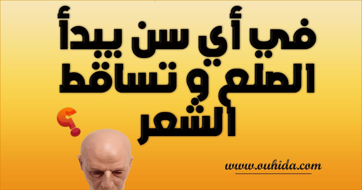 في أي سن يبدأ الصلع و تساقط الشعر. في أي سن يبدأ الصلع و تساقط الشعر.