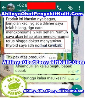 Cara Mengobati Nodul Tiroid Secara Alami Cara Mengobati Nodul Tiroid Secara Alami