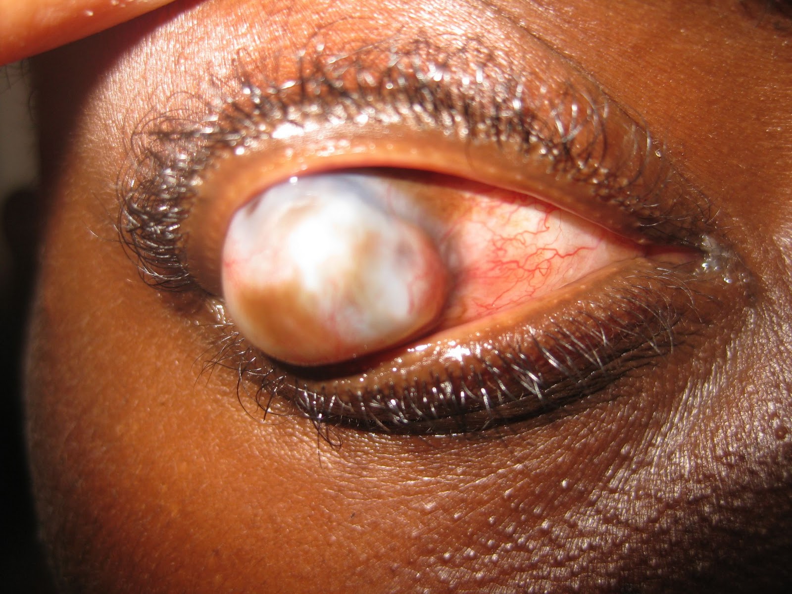 Yoos and Eyes in Zambia: October 2011