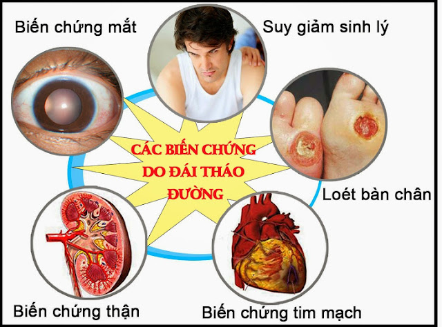 Các triệu chứng khác của bệnh tiểu đường tuýp 2