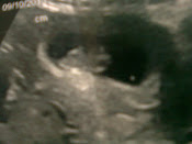 Baby 2nd picture