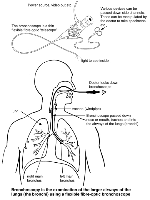 Ubat Antibiotik Tonsil  Umi Wasiati