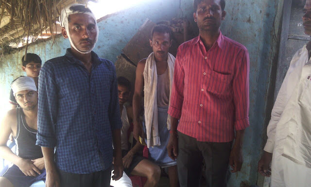 uttar-pradesh-police-encounter-sitapur-उत्तर प्रदेश-सीतापुर जिले के महोली-यूपी में पुलिस का तांडव गिरी तीन लाशें आधा दर्जन घायल uttar-pradesh-police-encounter-sitapur-उत्तर प्रदेश-सीतापुर जिले के महोली-यूपी में पुलिस का तांडव गिरी तीन लाशें आधा दर्जन घायल