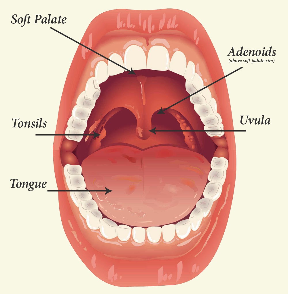 Remedies For Tonsil Problem Tonsil Ki Samasya Astro Uncle Ke Upay