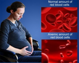  anemia semasa hamil