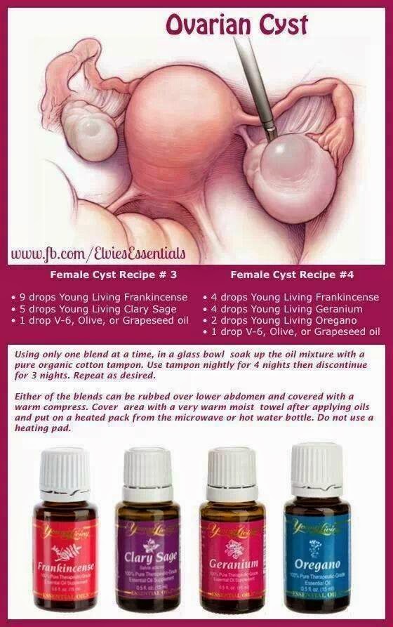 Essential oils ovarian cysts.