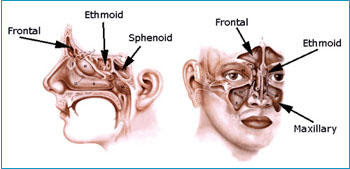 Sinus Infection Pictures: Symptoms, Causes and Treatment