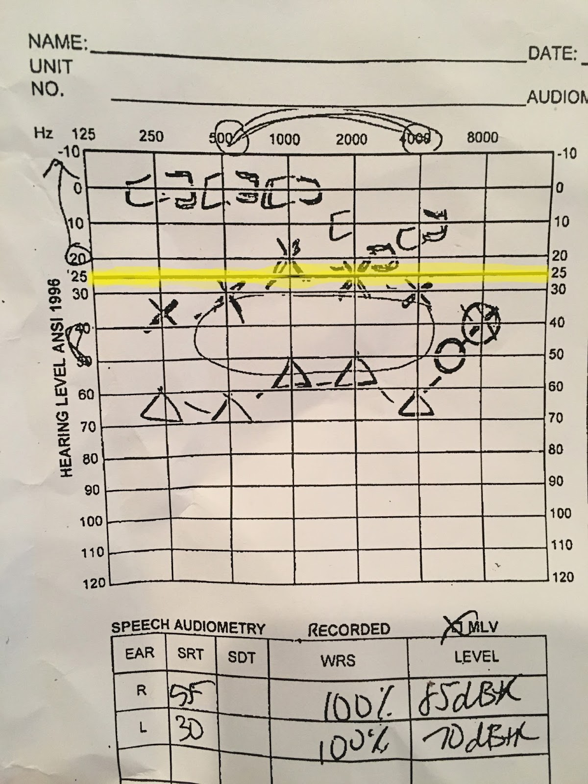 Unbelievable! Brian Regan'S Hearing Test Results Will Shock You - fr91ok7