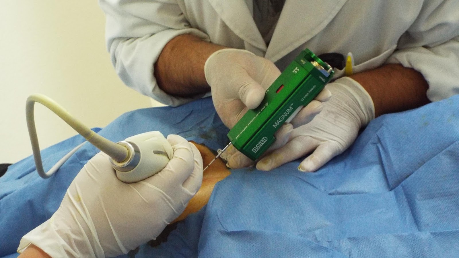 CÁNCER DE MAMA Diagnóstico CÁNCER DE MAMA Diagnóstico