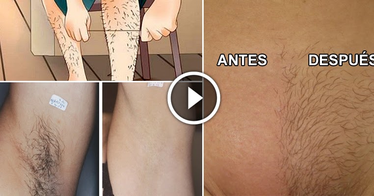 How To Naturally Remove Body Hair Permanently Style Hunt World