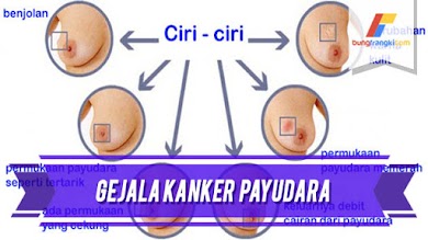Gejala Kanker Payud*ra yang Bisa Dilihat Langsung Gejala Kanker Payud*ra yang Bisa Dilihat Langsung
