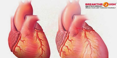 Kenali 4 Penyebab Jantung Bengkak