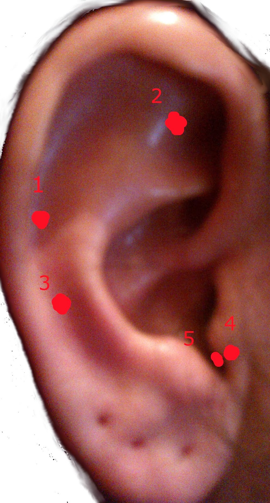 Consultoría Editorial Mexicana Auriculoterapia IV, Tratamiento para