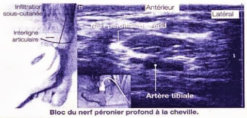 bloc-du-pied-la-cheville