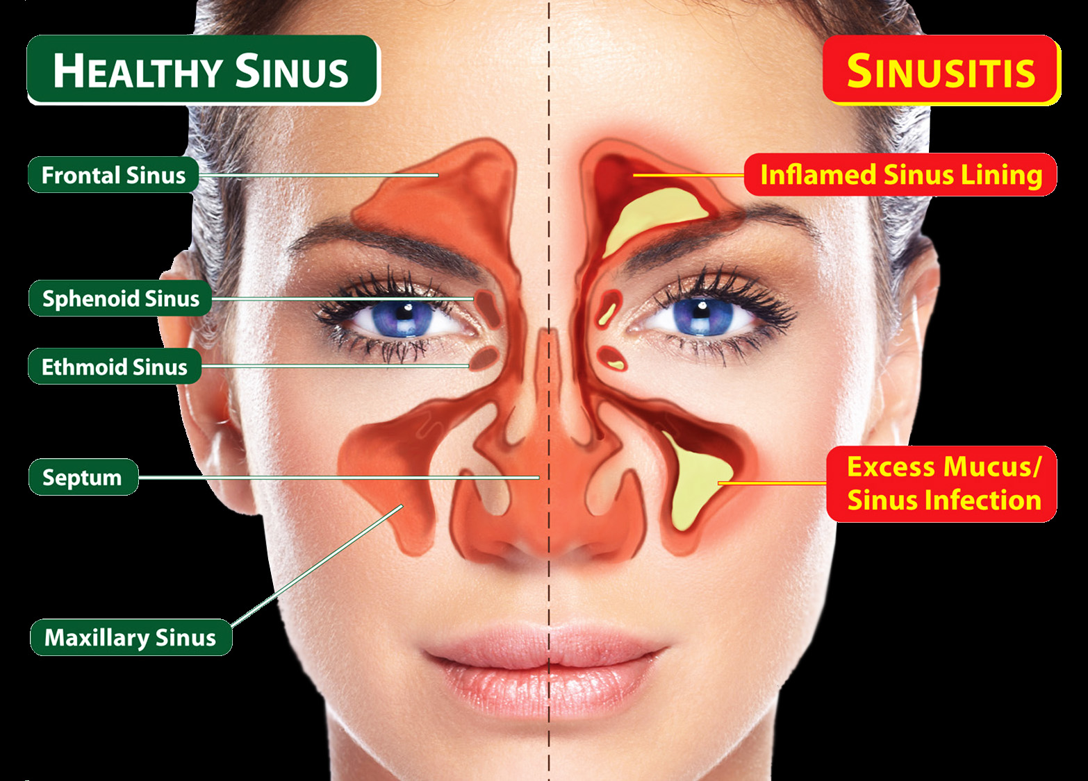 Thymos Anti Sinus/Nasal Allergies Spray Pulihkan Resdung 