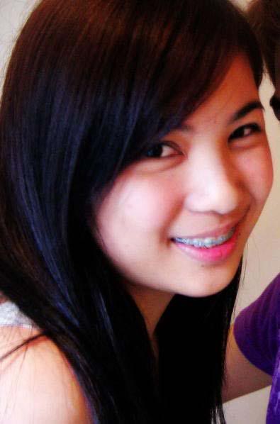 Hot Pinay Beautiful Smiles With Braces  Hot Pinays-4780