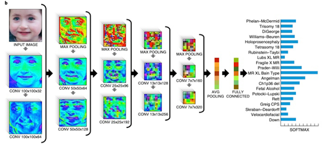 Machine Learning identifying rare genetic disorders