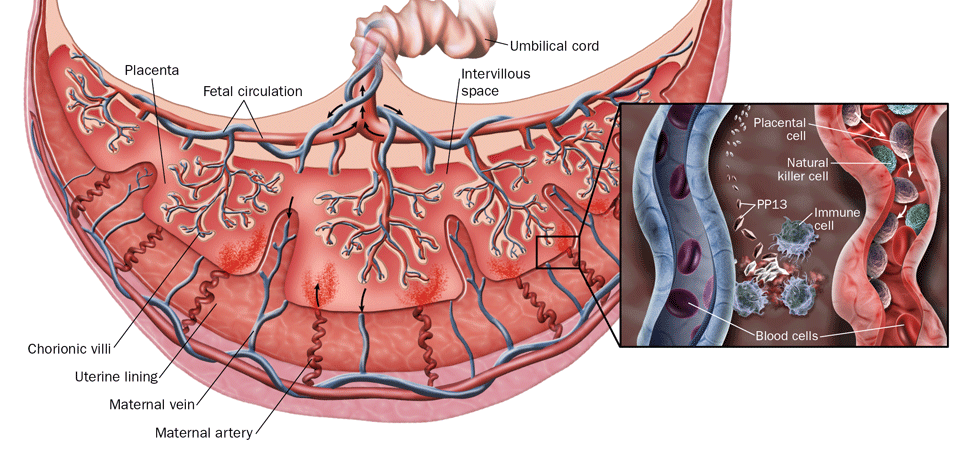 insuficiencia placentaria y diabetes gestacional