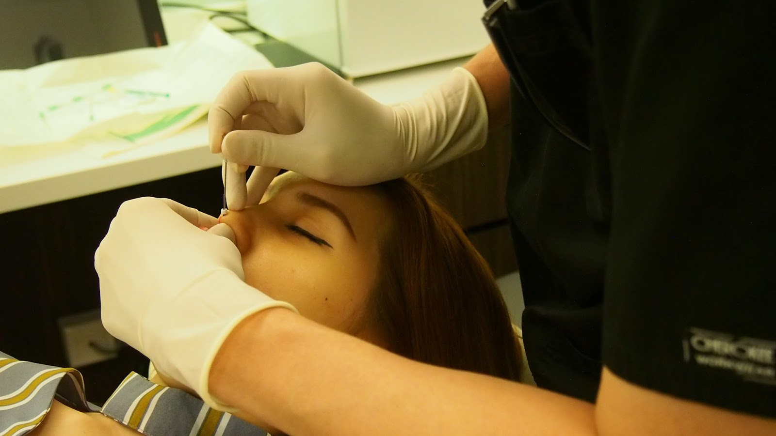 Dr Gerard Ee Clifford Nose thread lift Ultra V Hiko Nose Threads