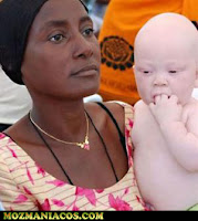 crianças albinas africanas