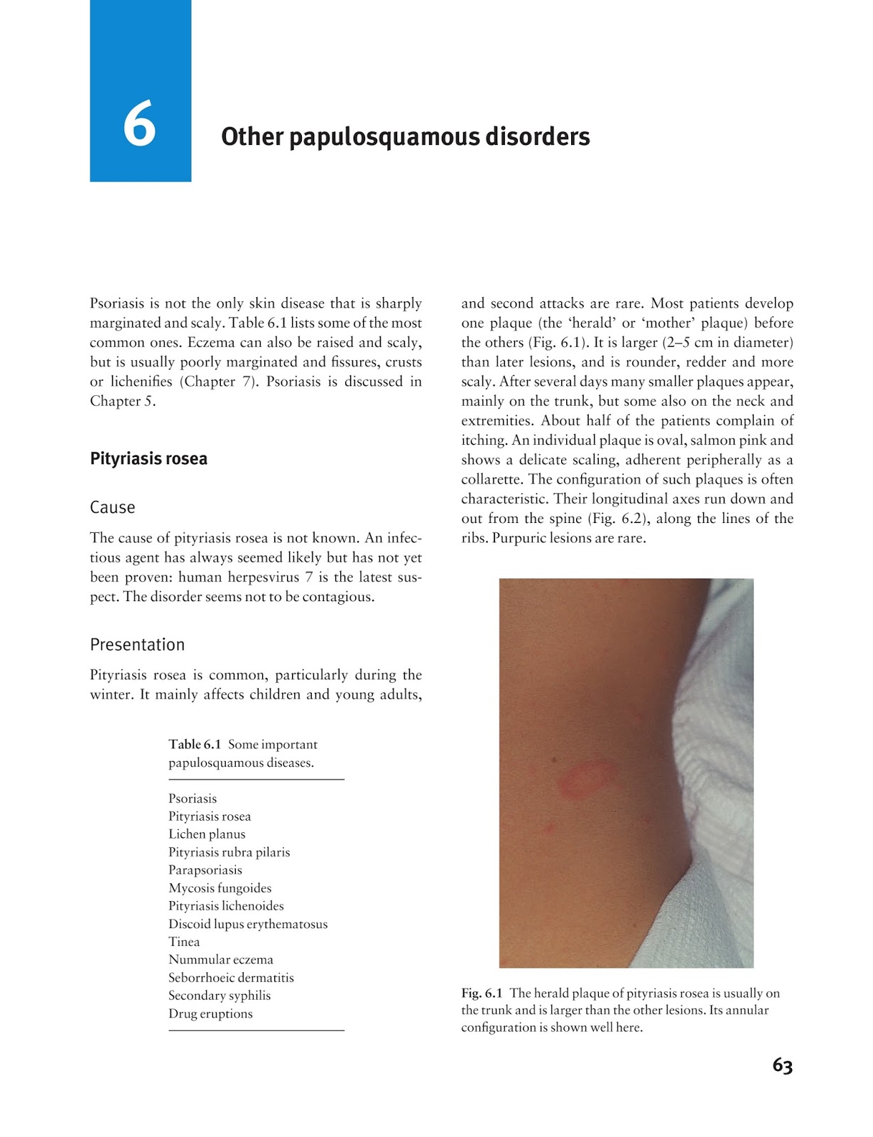 Medicine by Sfakianakis G. Alexandros: Skin disease in ...