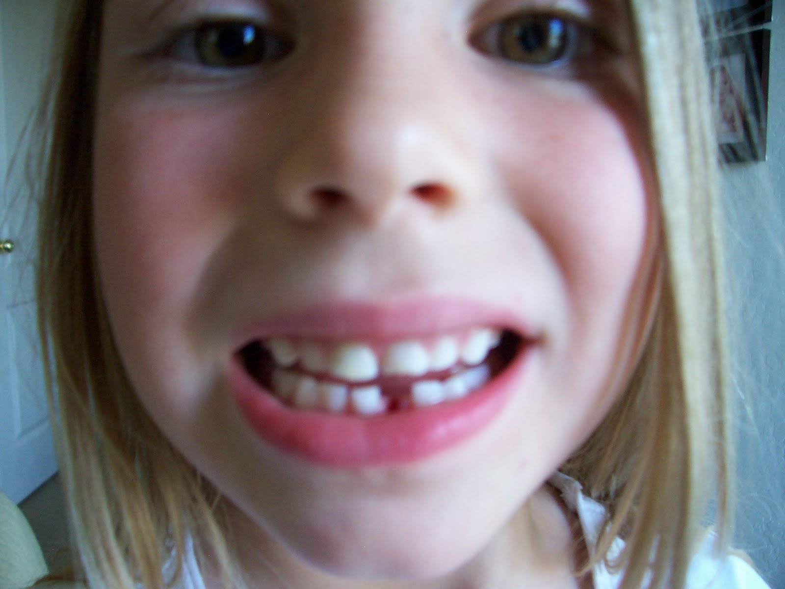 brandi-raae-shiloh-s-first-lost-tooth
