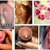 Obat Sipilis, Kencing Nanah, Gonore Di Apotik