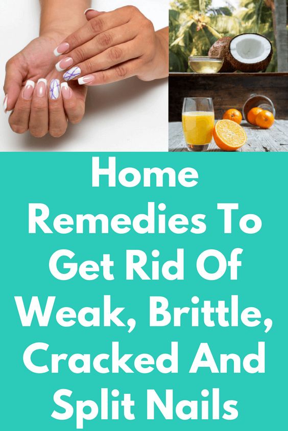 Home Remedies To Get Strong Nails TOP 5 DIY