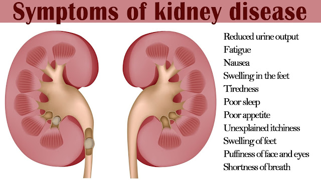 Most Common Habits That Damage Your Kidneys