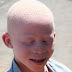 sliced to death: shocking fotos: 9 year old Malawi 'Albino' boy becomes the latest victim of the murderous 'Albino hunters'